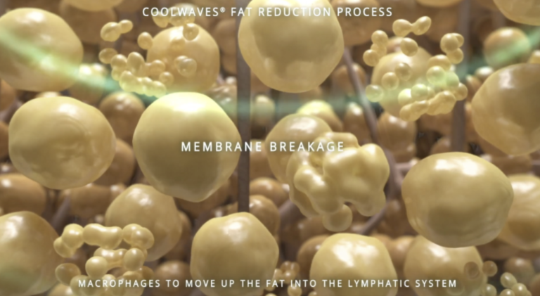 membrane-breakage