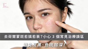 去荷爾蒙斑必看 | 拆解3大治療誤區，避免反黑、色斑加深！