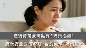 告別產後荷爾蒙斑 | 媽媽必讀高效去斑療程，預防反黑