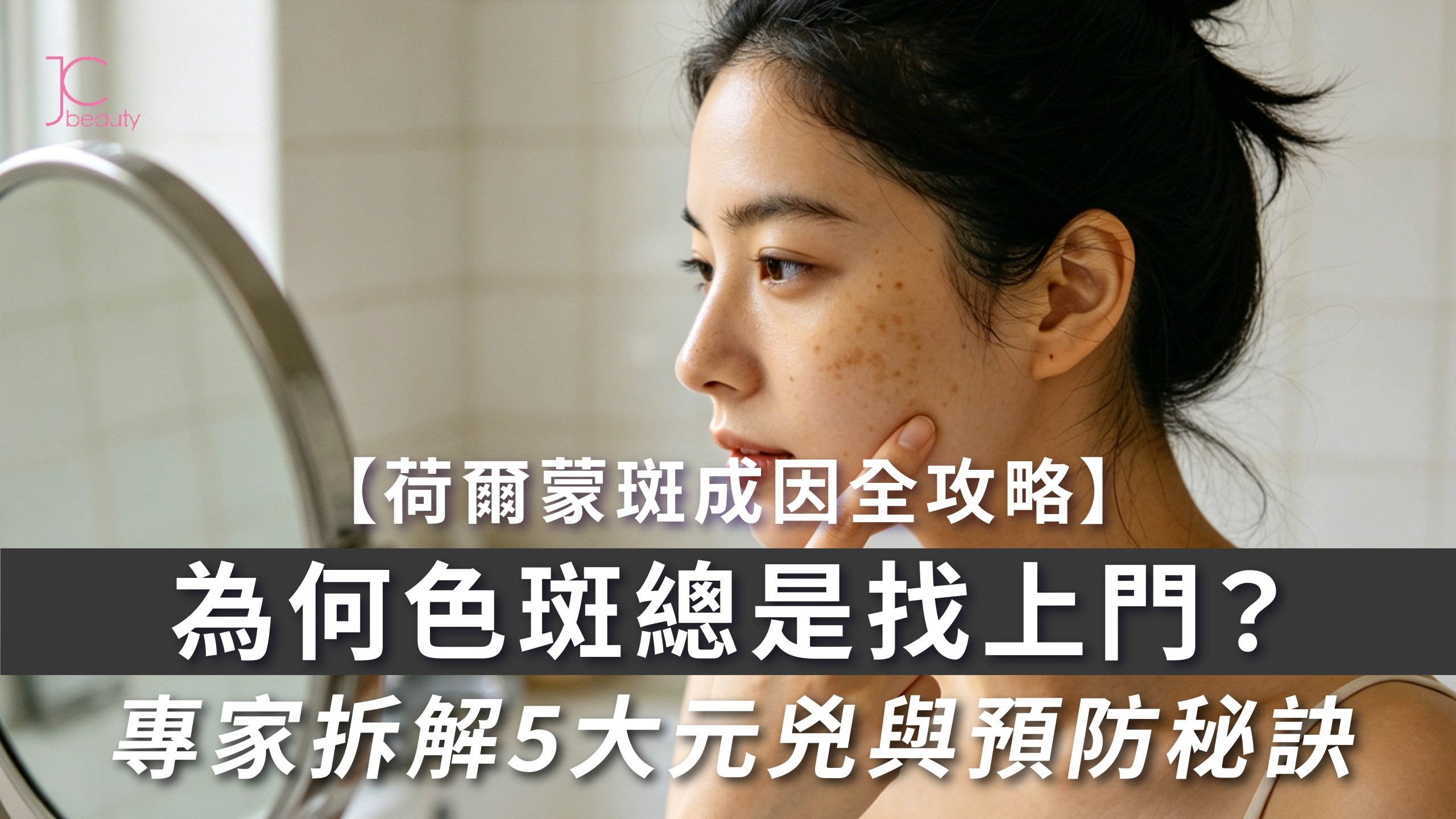 荷爾蒙斑成因全解析 | 專家揭秘5大元兇與預防秘訣,告別頑固色斑