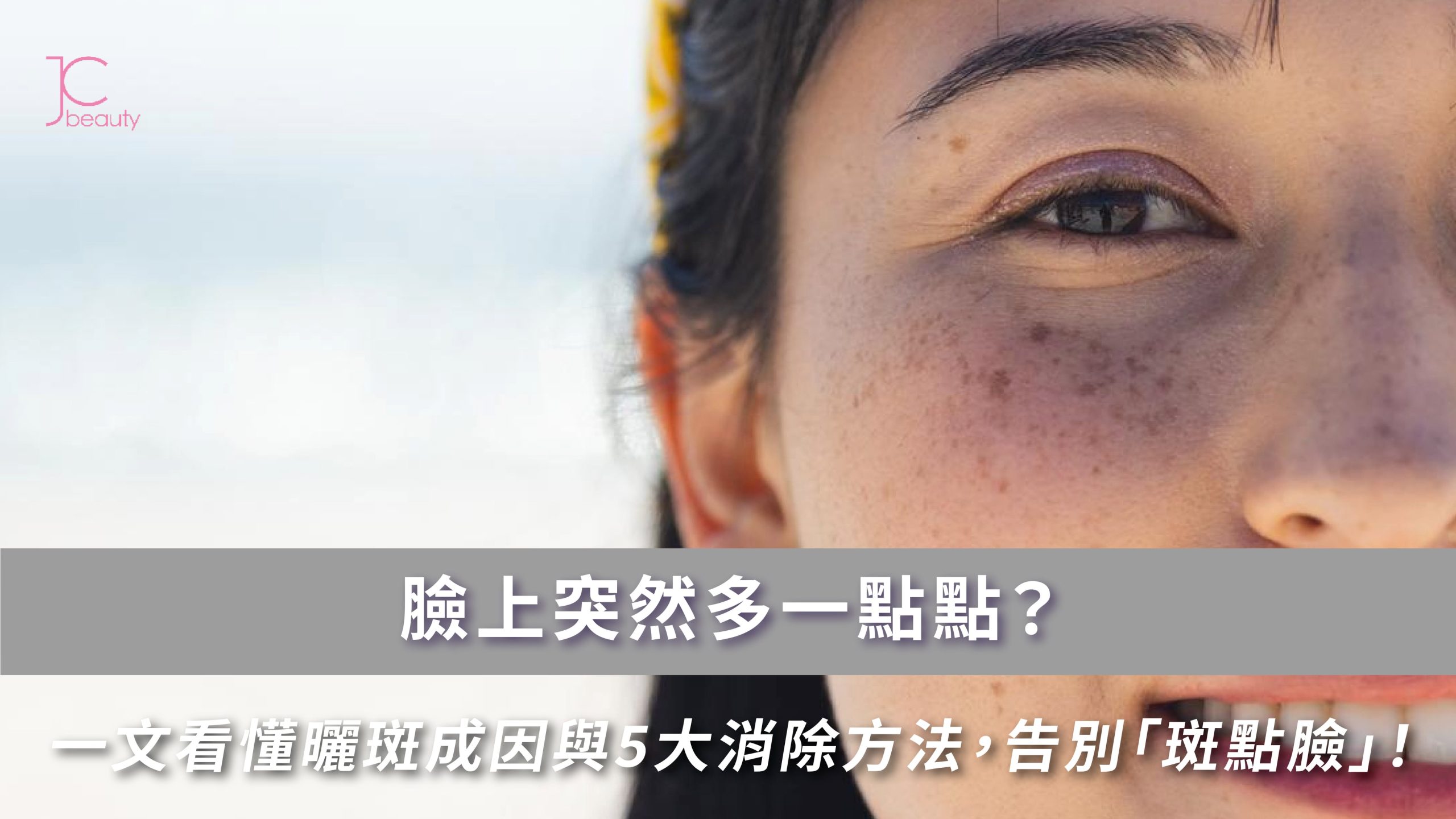 曬斑成因與消除方法全攻略 | 專家解析5大策略，預防激光反黑